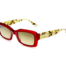 SOFO---BRBE---youoptics